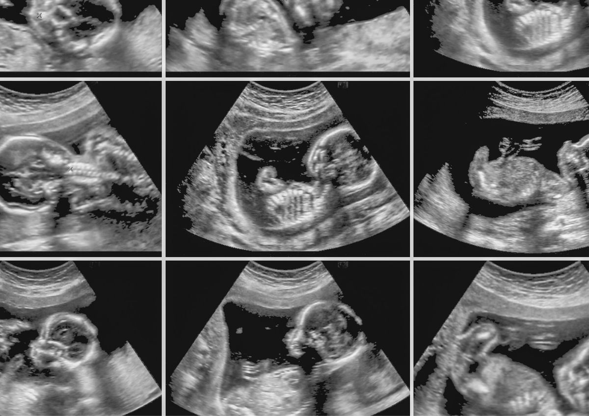 Gebelikte Bebeğinizin Sağlıklı Kilo Alımını Destekleme Yolları